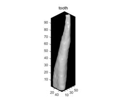 PMCT 3차원 치아 영상에서의 치수강 크기 자동 계산 모델 연구2